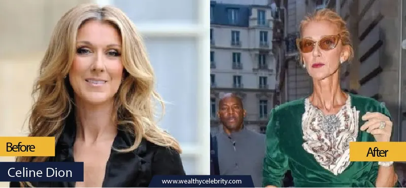 Celine Dion Weight Loss Story