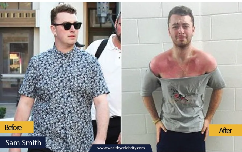 Sam Smith Weight Loss Story