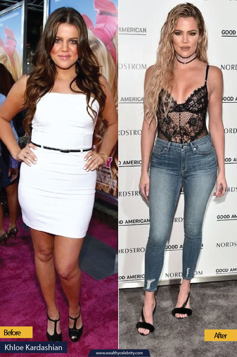 Khloe Kardashian Weight Loss Inspirational Story