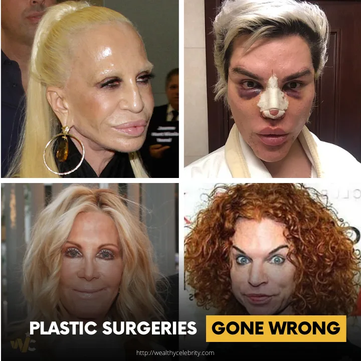 Celebrities Plastic surgeries gone terribly wrong